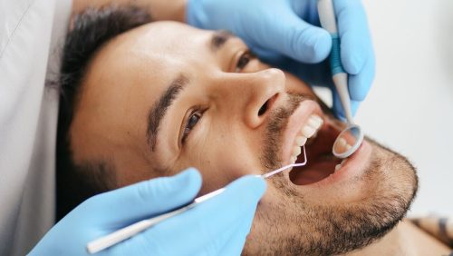 jovem-sorridente-sentado-na-cadeira-do-dentista-enquanto-o-medico-examina-os-dentes_158595-7733